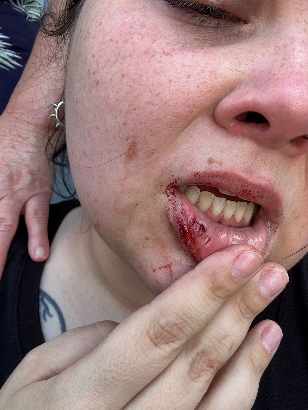 Mulher autista é agredida por Bombeiro Voluntário à paisana em Joinville